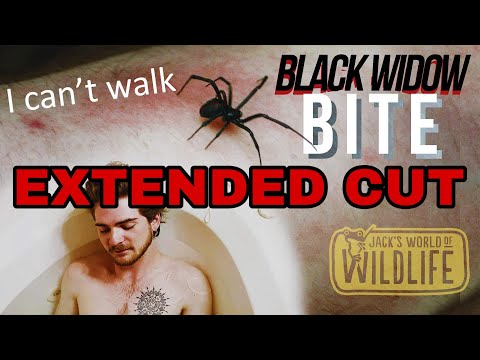 Black Widow BITE! The EXTENDED CUT